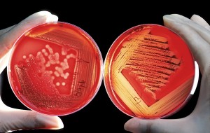 antibiotic-resistant